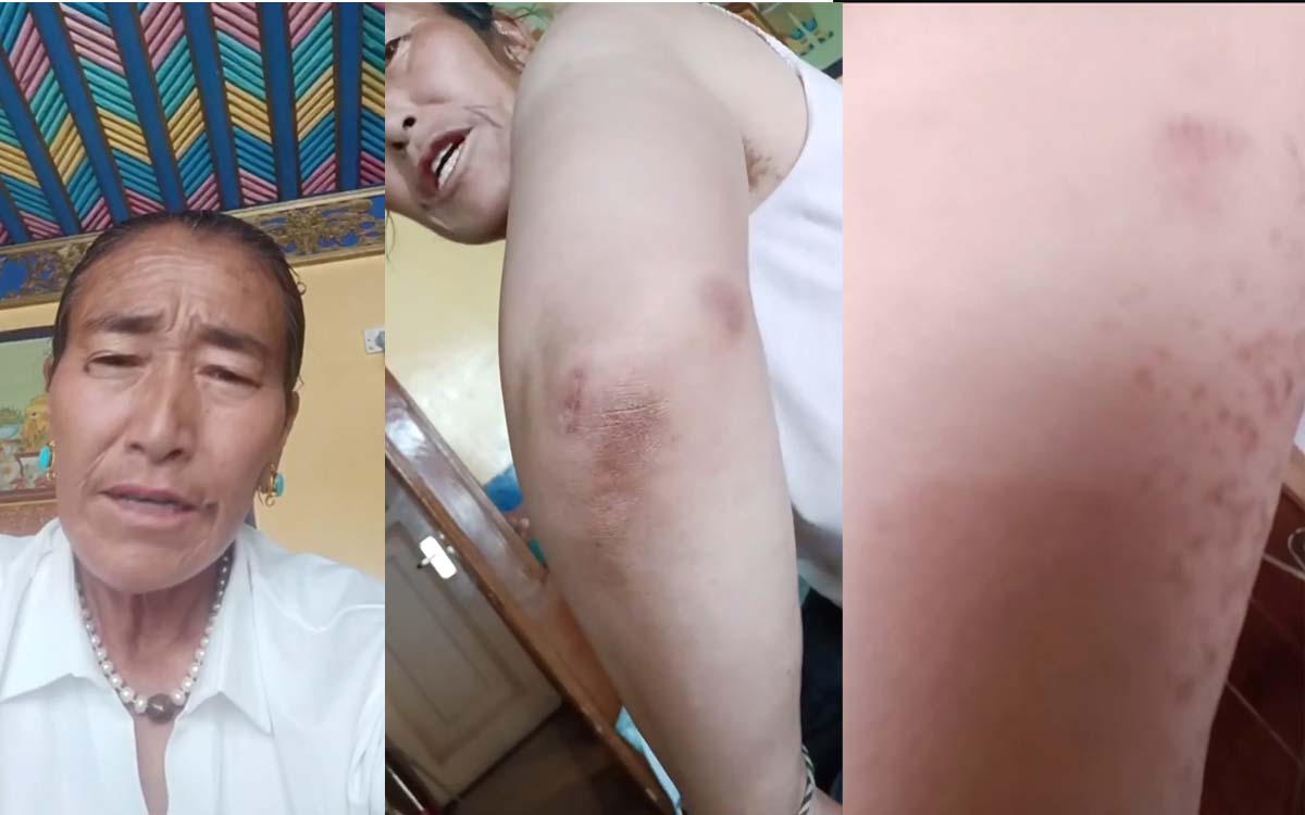 Chinese Police Officers Physically Abuse Gonpo Kyi
